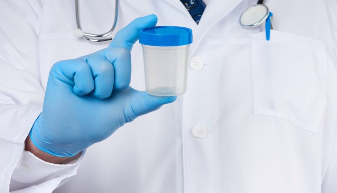 Male doctor in a white coat and tie stands and holds a plastic container for urine specimen