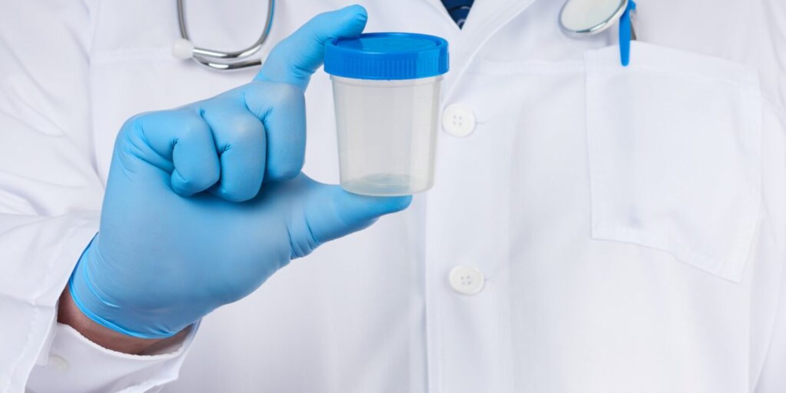 Male doctor in a white coat and tie stands and holds a plastic container for urine specimen