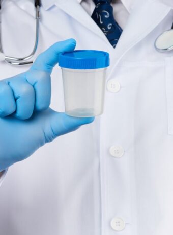 Male doctor in a white coat and tie stands and holds a plastic container for urine specimen