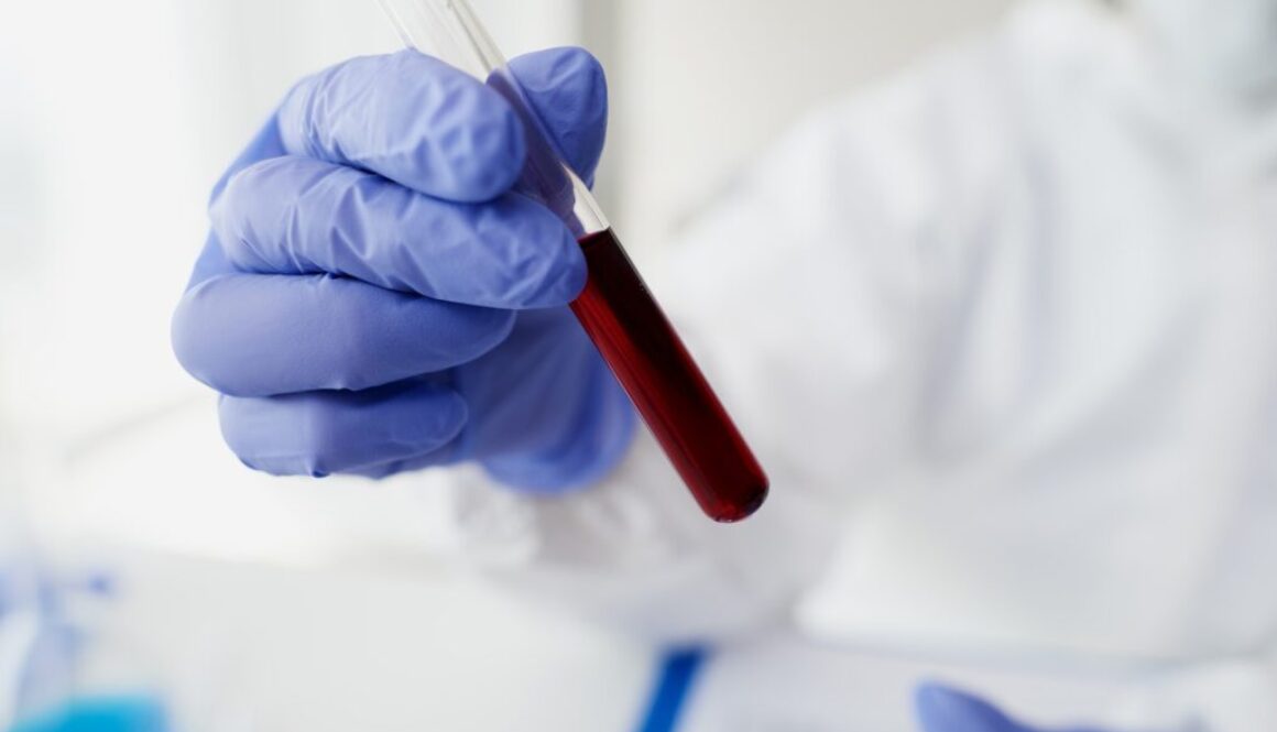 Wie lange ist THC nachweisbar?